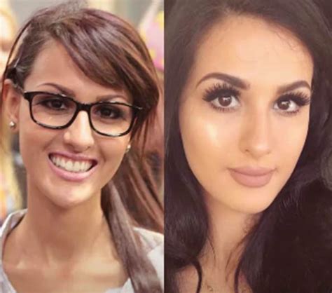 Sssniperwolf Before Plastic Surgery: How Was She。